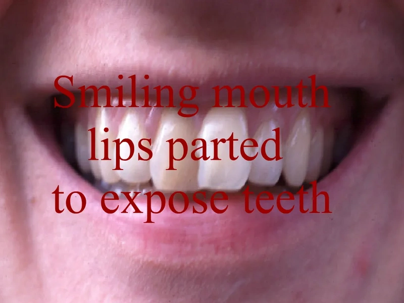 File:Mouth2.webp