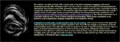 Thumbnail for version as of 13:35, 18 March 2026