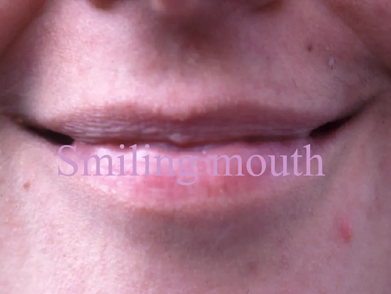 File:Mouth1.webp